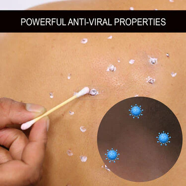 Ayurvedic Massa Removal Cream - Image 4
