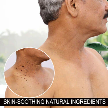 Ayurvedic Massa Removal Cream - Image 5