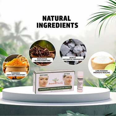 Ayurvedic Massa Removal Cream - Image 6