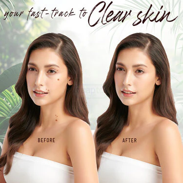 Ayurvedic Massa Removal Cream - Image 7