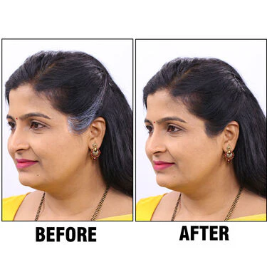 Instant Hair Colour Touch-up - Pick Any 1 - Image 7