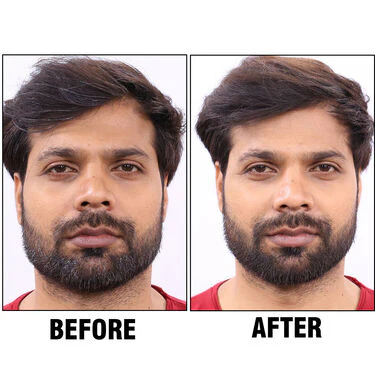 Instant Hair Colour Touch-up - Pick Any 1 - Image 8
