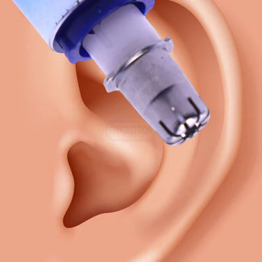 Painless Nose & Ear Hair Trimmer (NHC7) - Image 6
