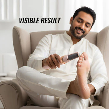 Rechargeable Callus Remover For Feet (RFF5) - Image 5